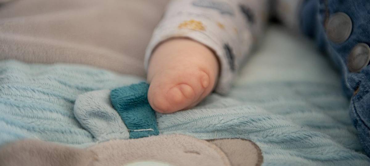 Eine Hand eines Babys mit fehlgebildeten Fingern