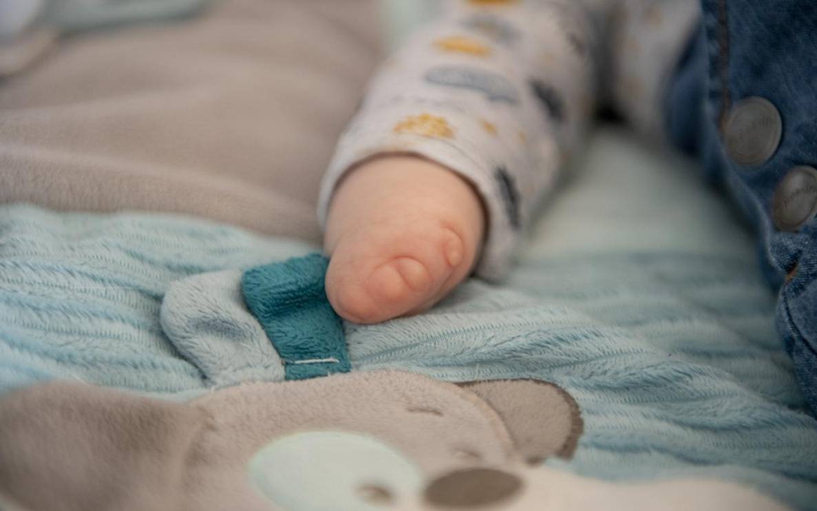 Eine Hand eines Babys mit fehlgebildeten Fingern