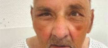 Bottrop: Polizeihubschrauber sucht Vermissten