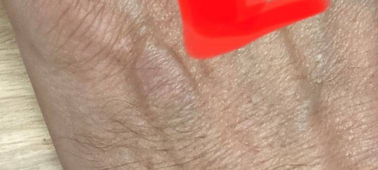 Kreditkarte unter der Haut: NFC-Chip als Implantat