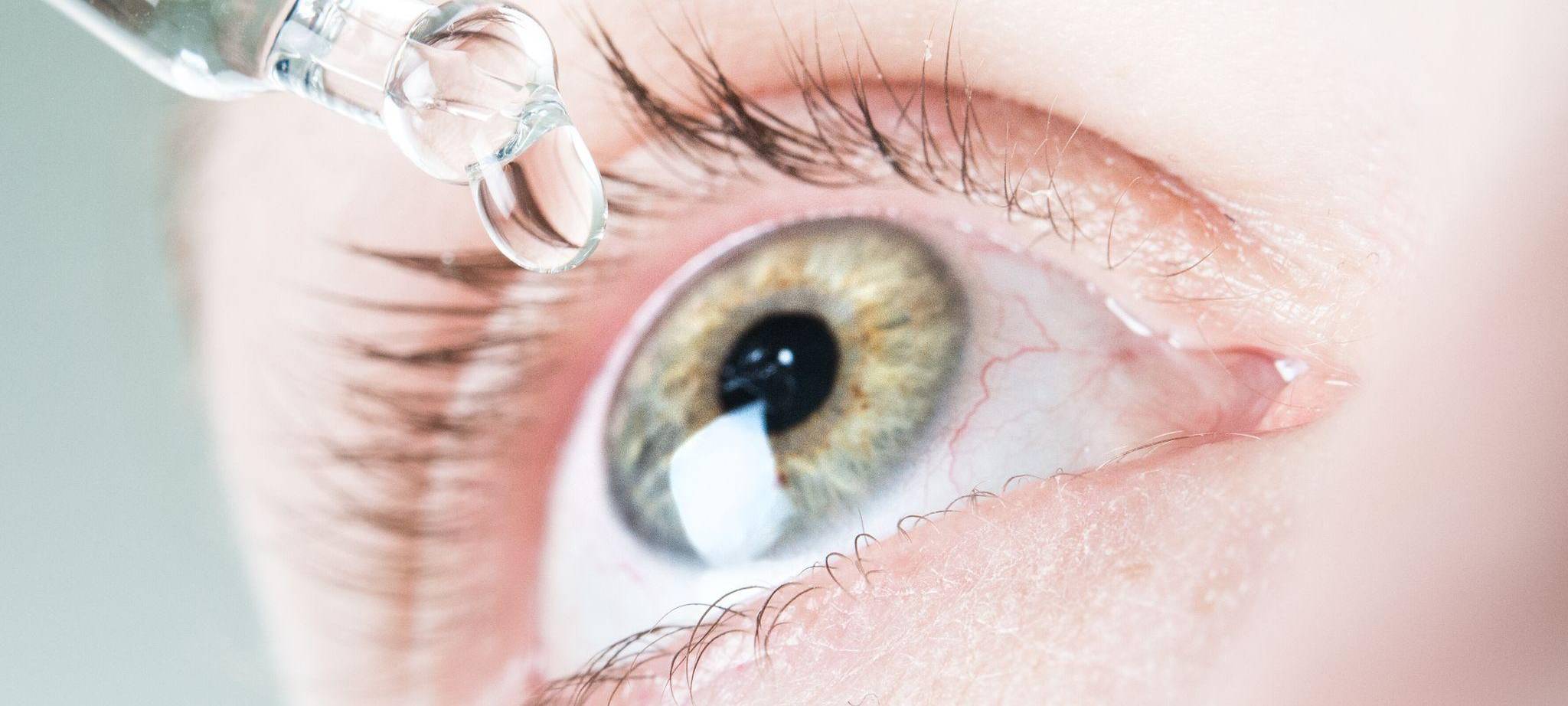 Frau benutzt befeuchtende Augentropfen