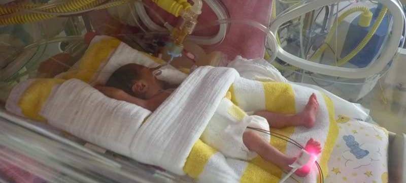 Ein zwei Tage altes Frühchen in der Kinderklinik des Marienhospitals in Bottrop.